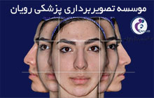 مرکز تخصصی فتوگرافی در کرج